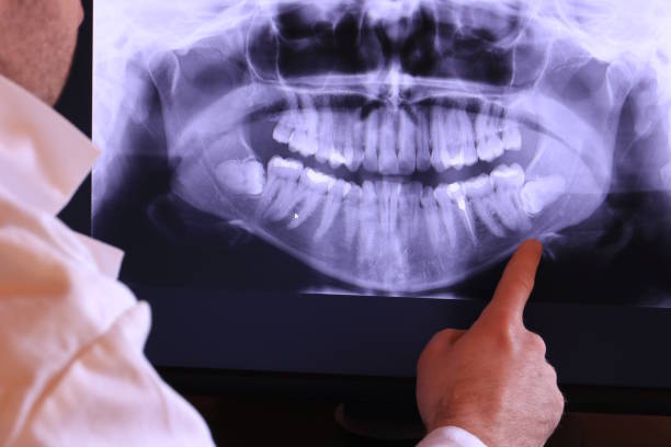 Best Cracked Tooth Emergency Dentist  in Round Lake Park, IL